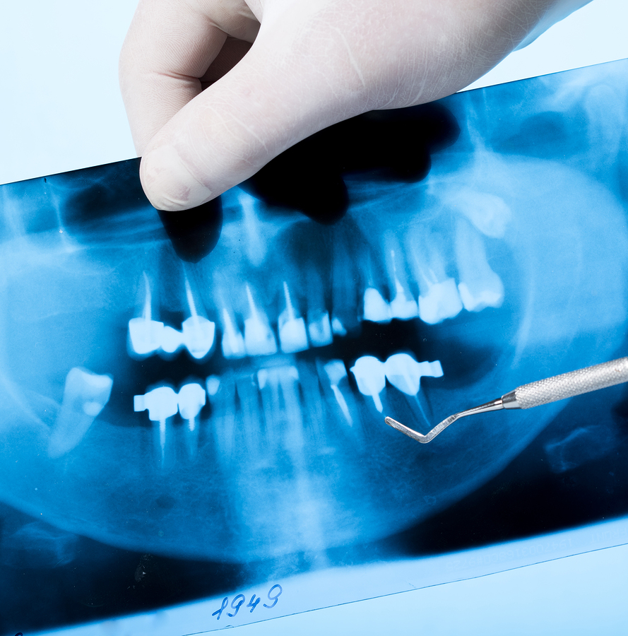ATM e DTM: O que são, quais as causas, sintomas e tratamentos para as  disfunções da articulação da mandíbula?